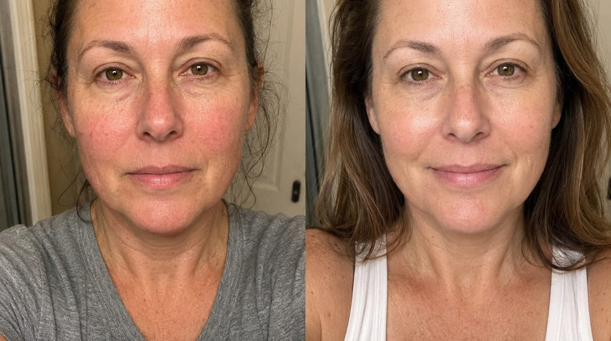 Linda M. before and after